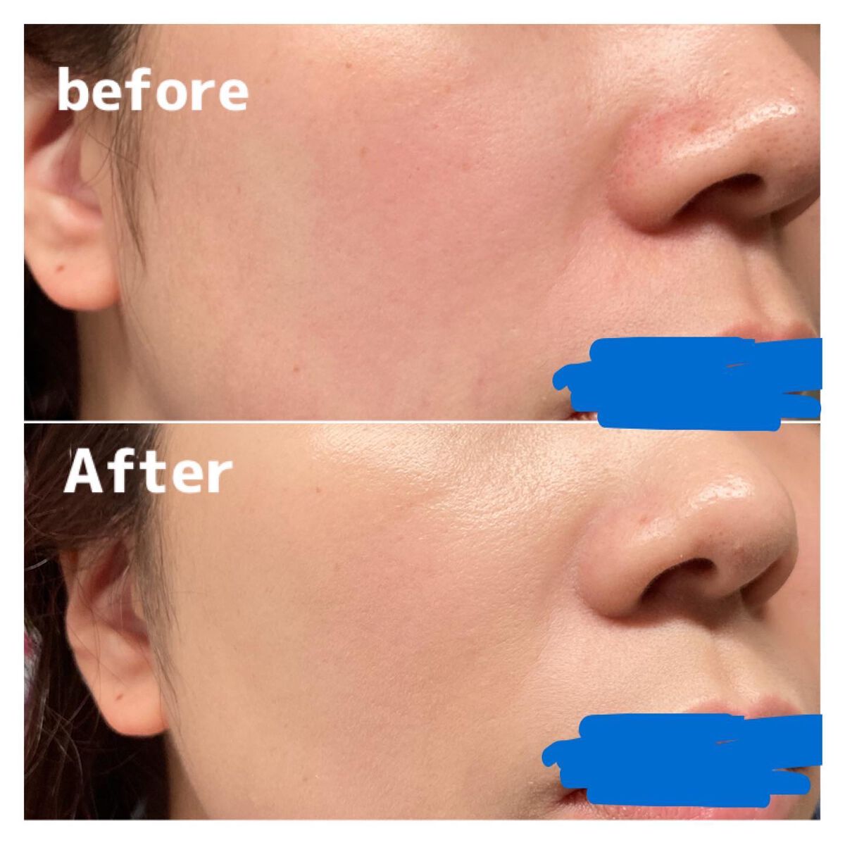 ミストBBクッション(リフィル込)/Pittoresco/クッションファンデーションを使ったクチコミ(10枚目)