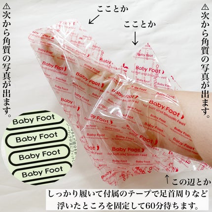 イージーパックDP60分タイプ/ベビーフット/レッグ・フットケアを使ったクチコミ(6枚目)