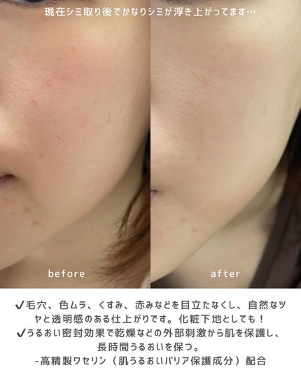 薬用フェイスプロテクトUV ミルク/IHADA/日焼け止めミルクを使ったクチコミ(4枚目)