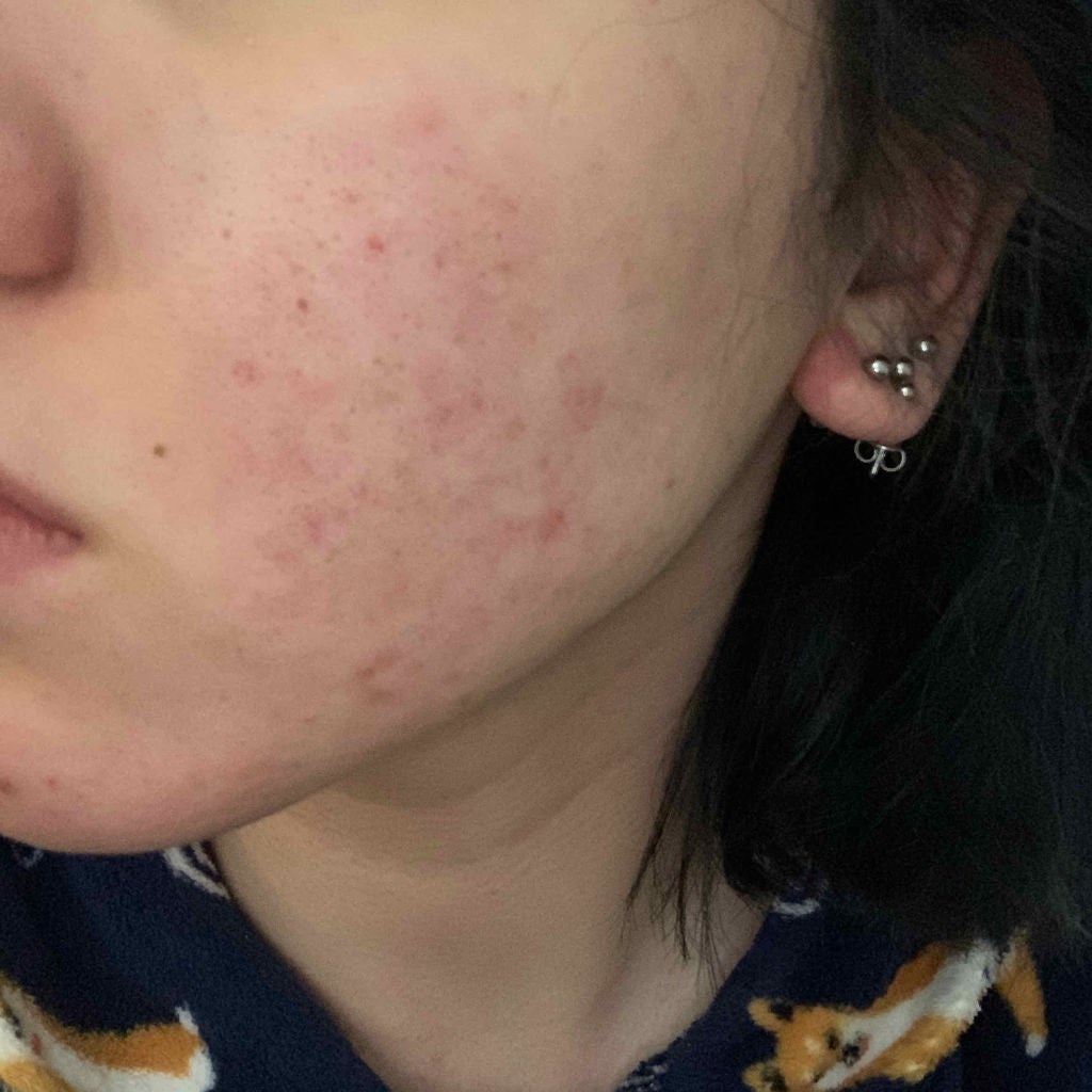 7 day Special Set プログラム3/b.glen/トライアルキットを使ったクチコミ(2枚目)