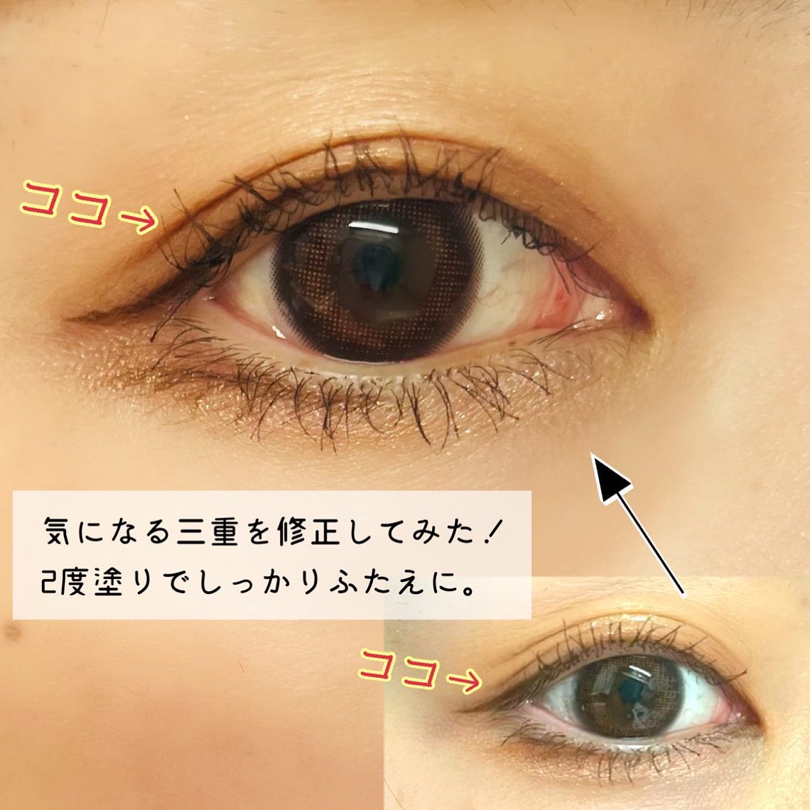 メザイク イージークリア 接着クリアタイプ/メザイク/二重まぶた用アイテムを使ったクチコミ（3枚目）