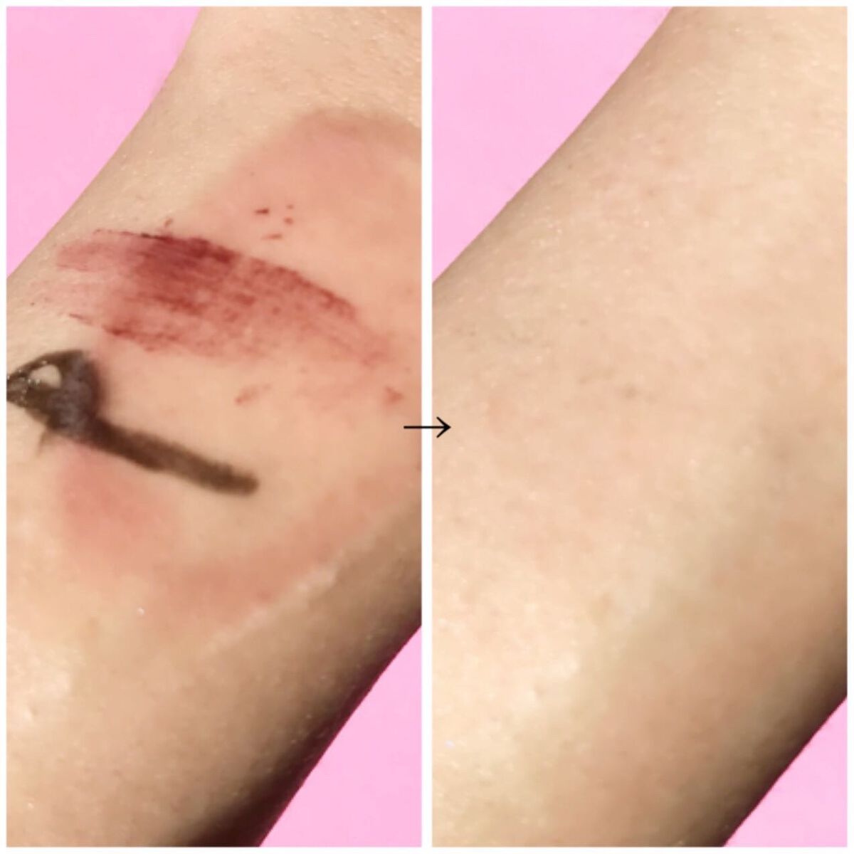 シュワとろオイル泡クレンジング/ビフェスタ/オイルクレンジングを使ったクチコミ（3枚目）