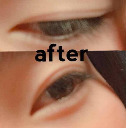 アイテープ 埋没式両面テープ/DAISO/二重まぶた用アイテムを使ったクチコミ(4枚目)