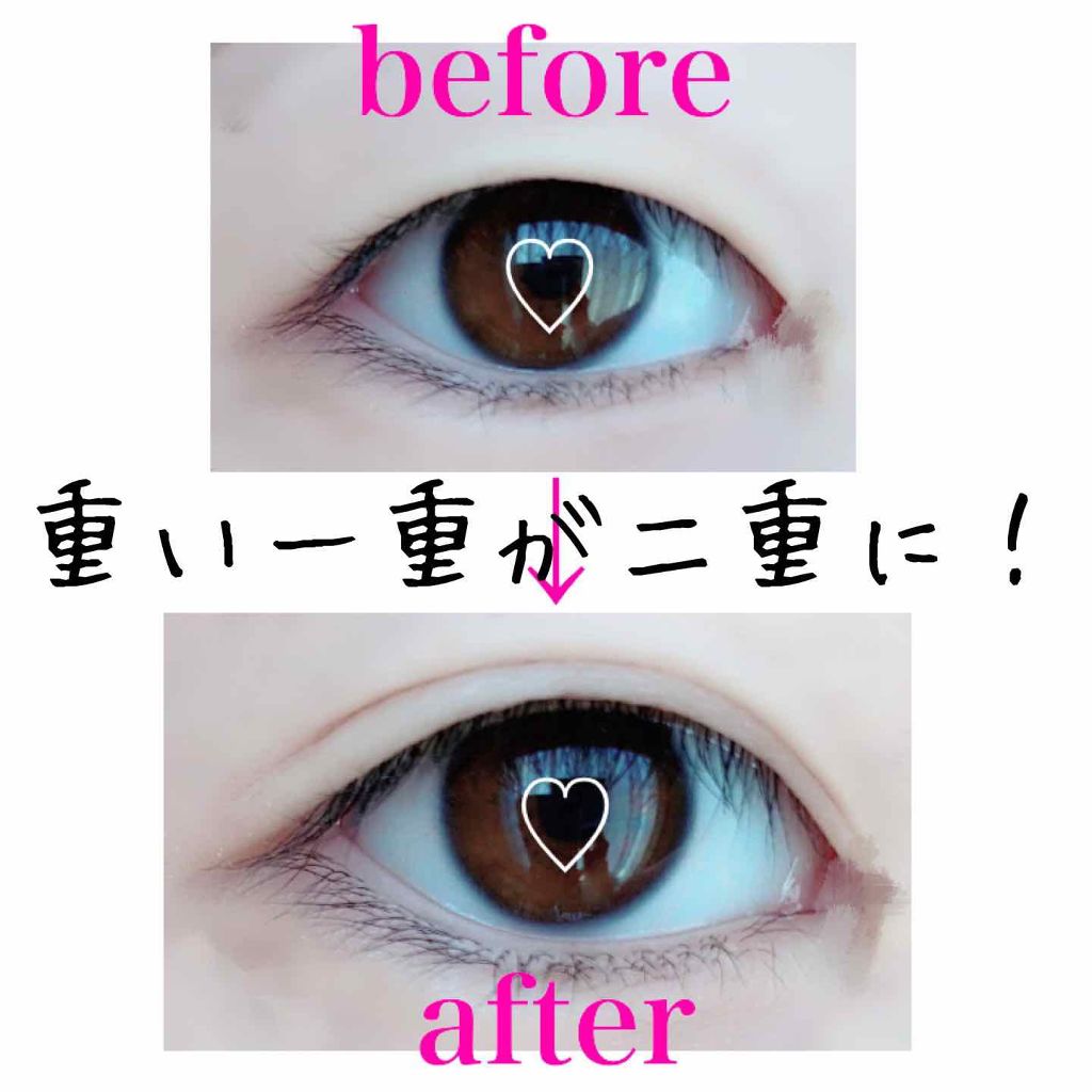 アイビューティー フィクサー WP/アストレア ヴィルゴ/二重まぶた用アイテムを使ったクチコミ(1枚目)