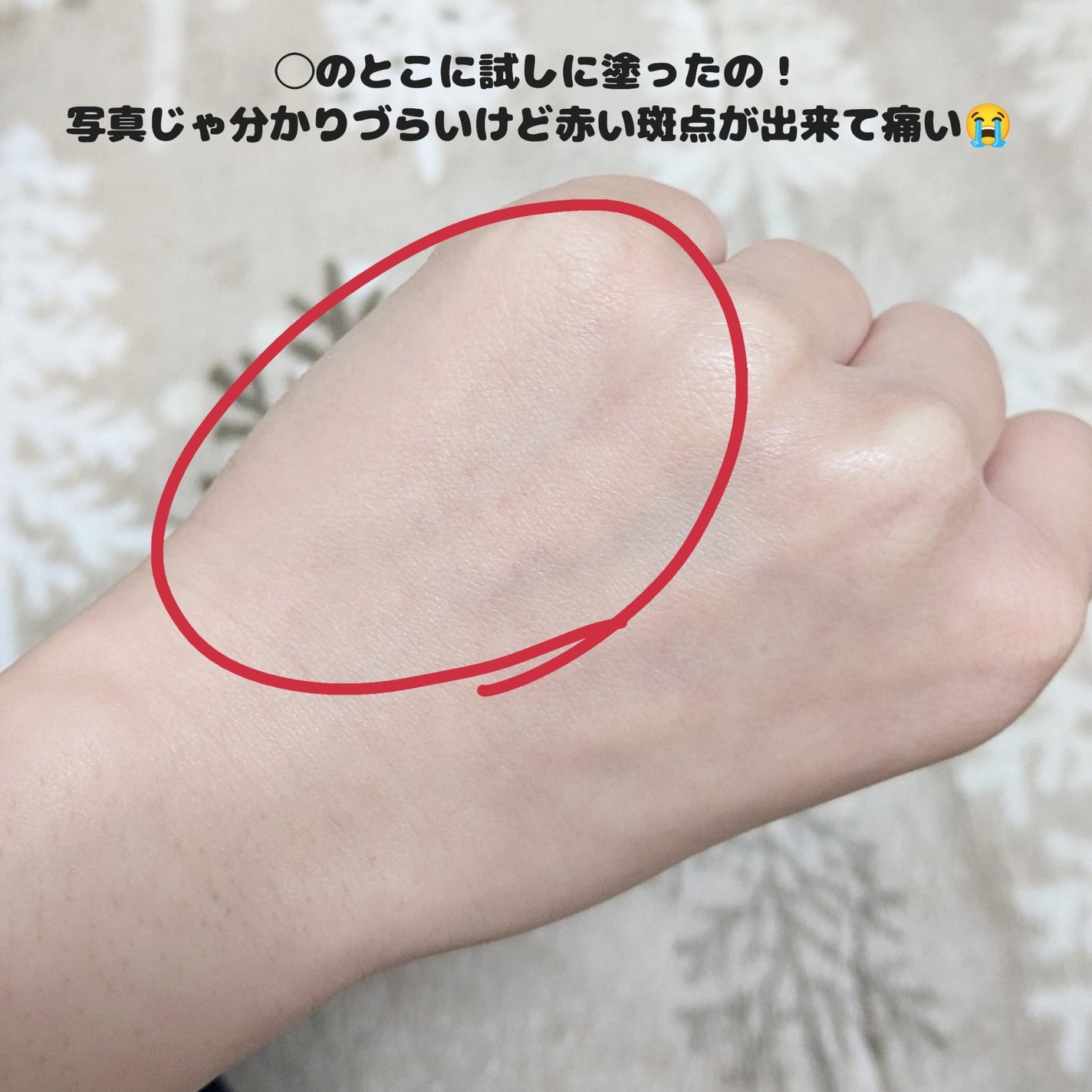 リードルショット700/VT/美容液を使ったクチコミ(2枚目)