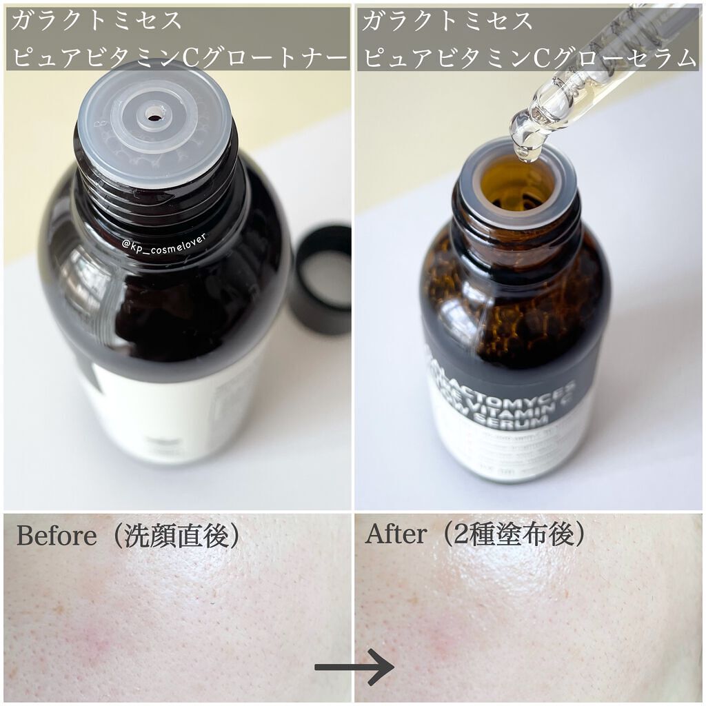 ガラクトミセスピュアビタミンCグローセラム/SOME BY MI/美容液を使ったクチコミ（3枚目）