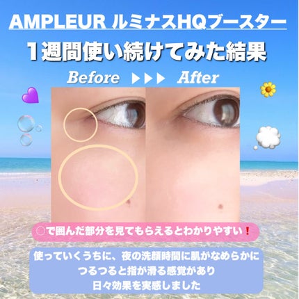 ルミナスHQブースター/アンプルール/ブースター・導入液を使ったクチコミ(5枚目)