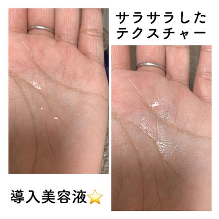 タカミスキンピール/タカミ/ブースター・導入液を使ったクチコミ(4枚目)