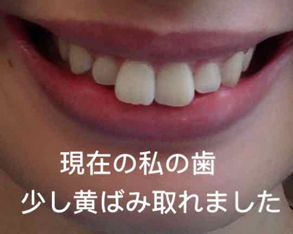 タンクリーニングジェル アンドキス ピンクグレープフルーツミント/サンタマルシェ/その他オーラルケアを使ったクチコミ（3枚目）