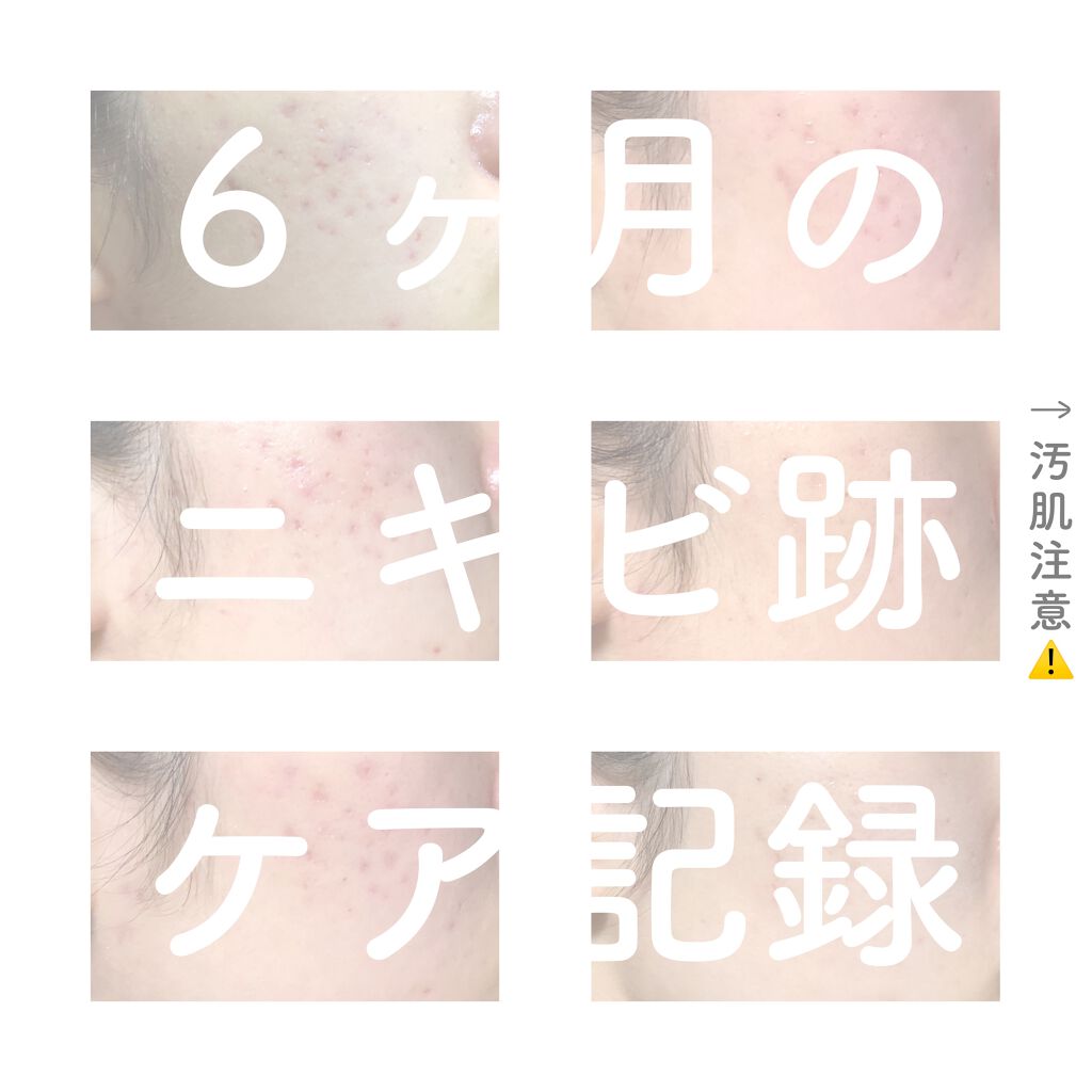 キールズ DS クリアリーブライト エッセンス[医薬部外品]/Kiehl's/美容液を使ったクチコミ（1枚目）