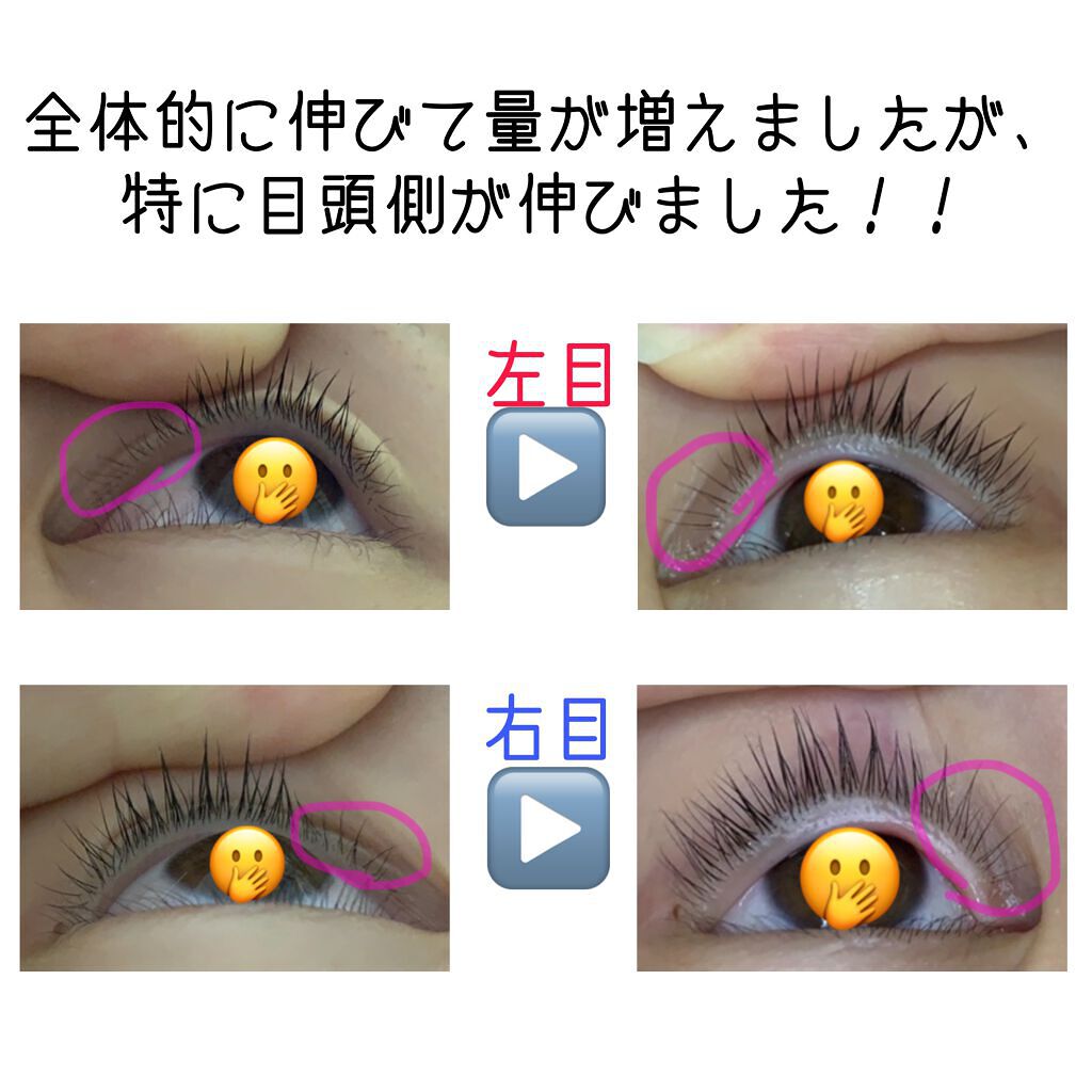 まつげ美容液EX/CEZANNE/まつげ美容液を使ったクチコミ（3枚目）