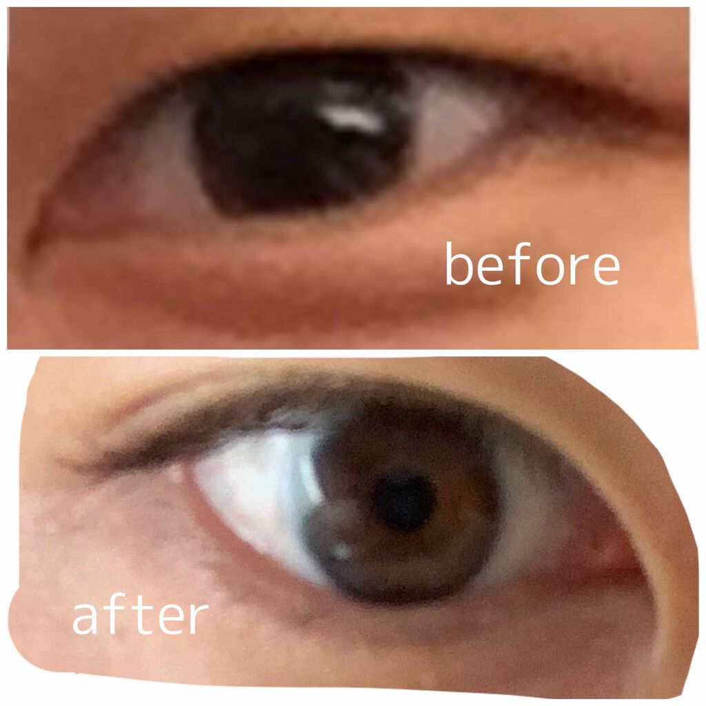 アイトーク/アイトーク/二重まぶた用アイテムを使ったクチコミ(1枚目)