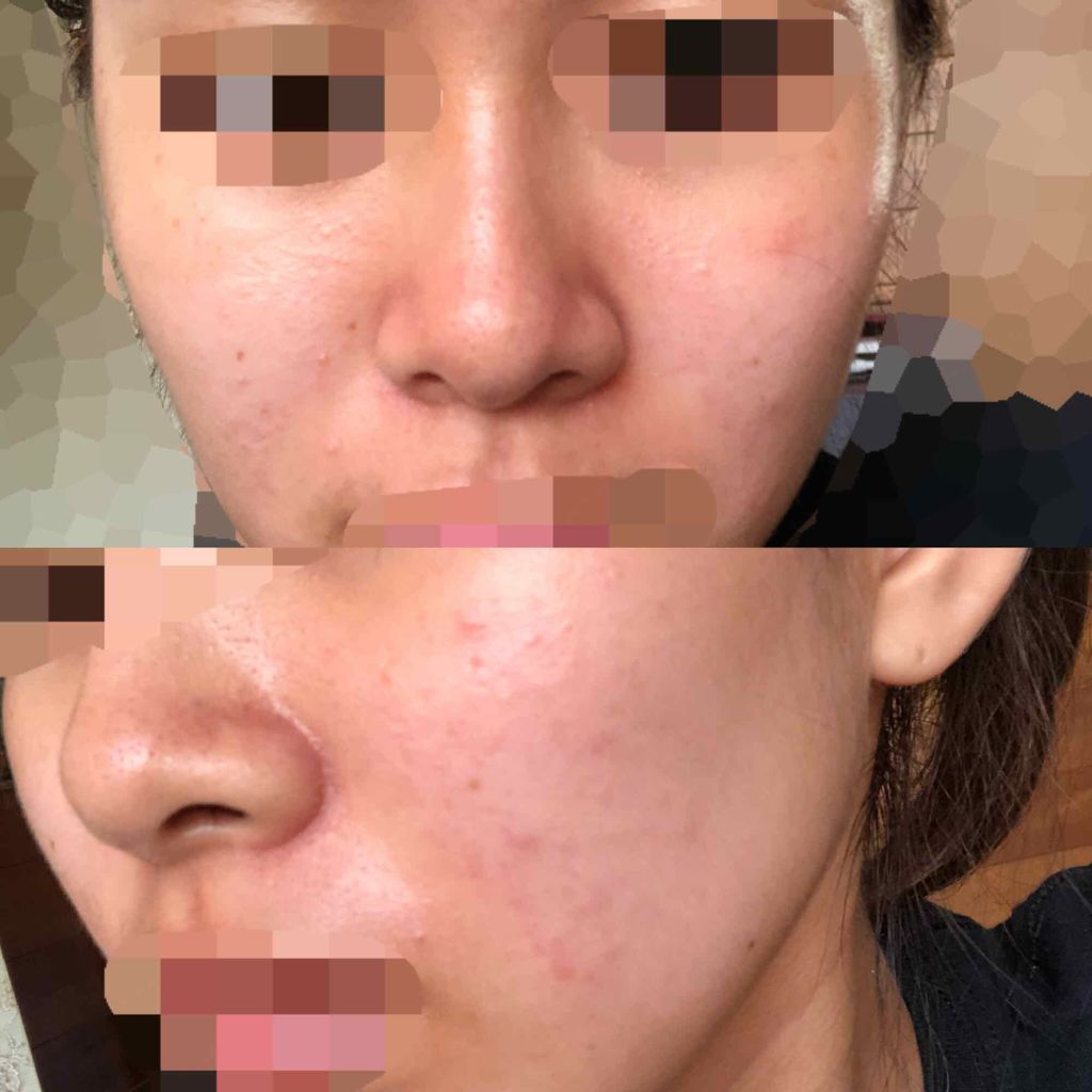 明色美顔水 薬用化粧水/美顔/化粧水を使ったクチコミ（2枚目）