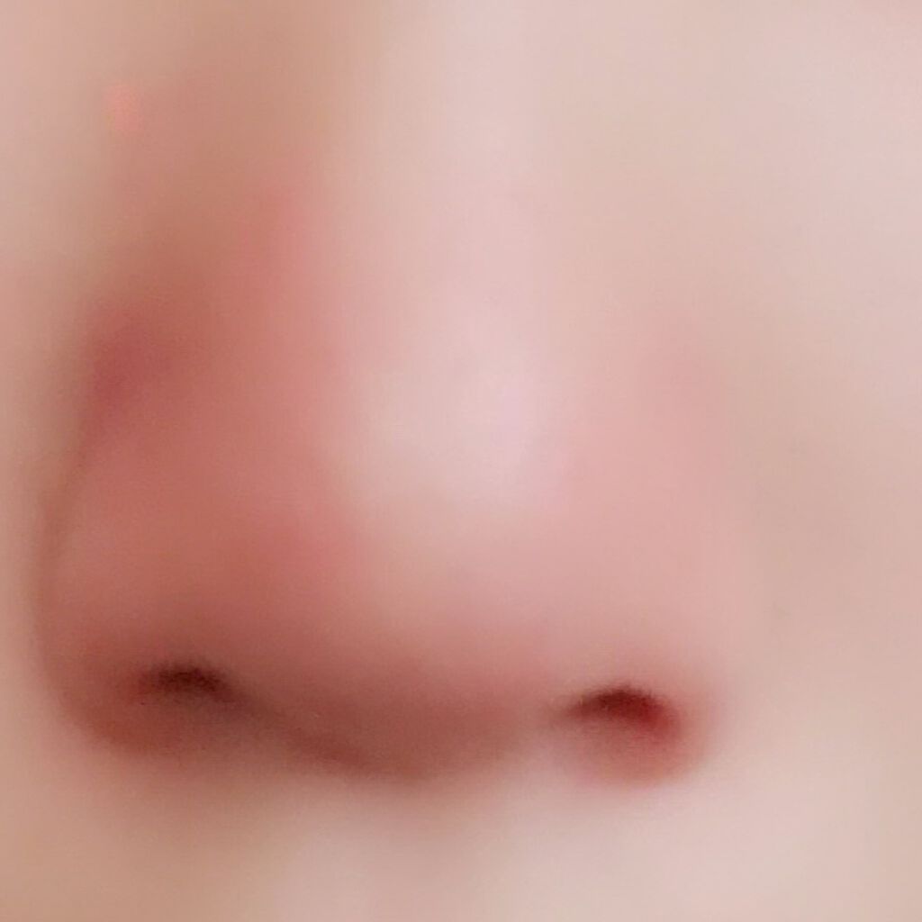 まほ on LIPS 「汚い鼻をお見せしてすみません。自分の結果報告みたいなものです。..」(3枚目)