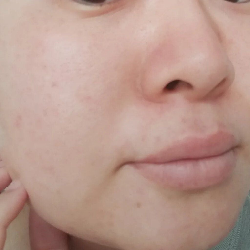 VC ホワイトピールセラム/SKIO/ブースター・導入液を使ったクチコミ(5枚目)