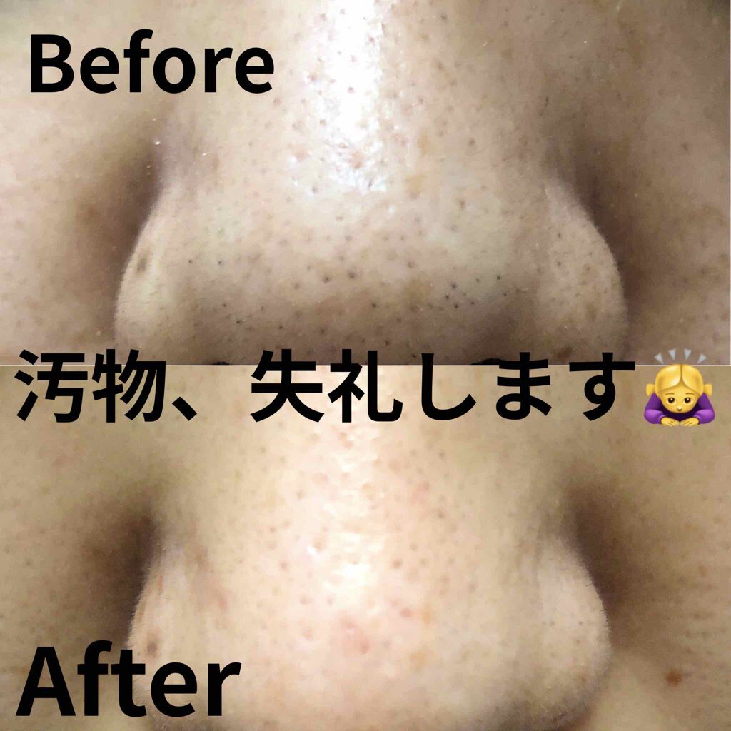 充電式 音波振動洗顔ブラシ/ニトリ/その他スキンケアグッズを使ったクチコミ(2枚目)