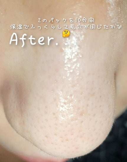 アンチポアブラックヘッドパーフェクトクリアキット/CNP Laboratory/シートマスク・パックを使ったクチコミ(5枚目)