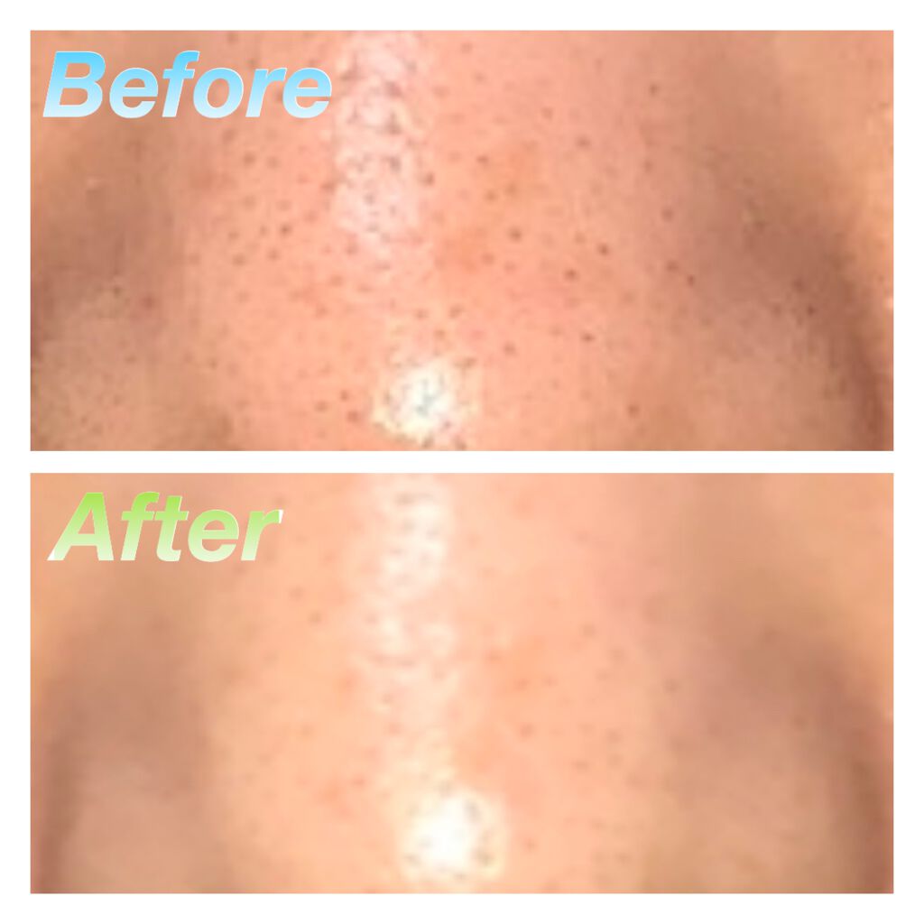 小鼻専用 洗顔ブラシ/DAISO/その他スキンケアグッズを使ったクチコミ（3枚目）