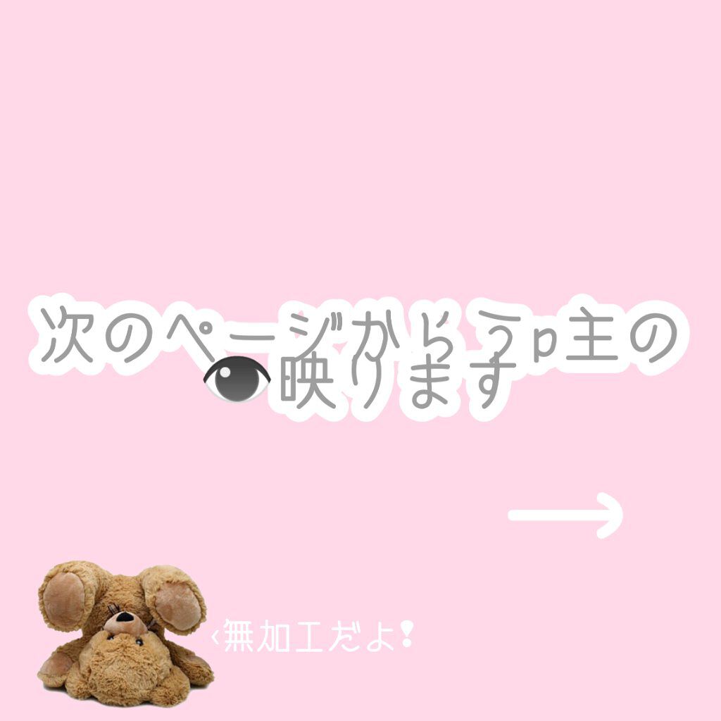 太郎 on LIPS 「お久しぶりです❢太郎と申します❢この度私太郎は念願の埋没をして..」(2枚目)