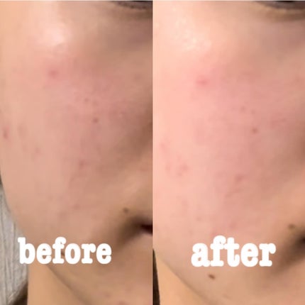 世界の果実 すっきり泡洗顔/世界の果実/泡洗顔を使ったクチコミ(4枚目)