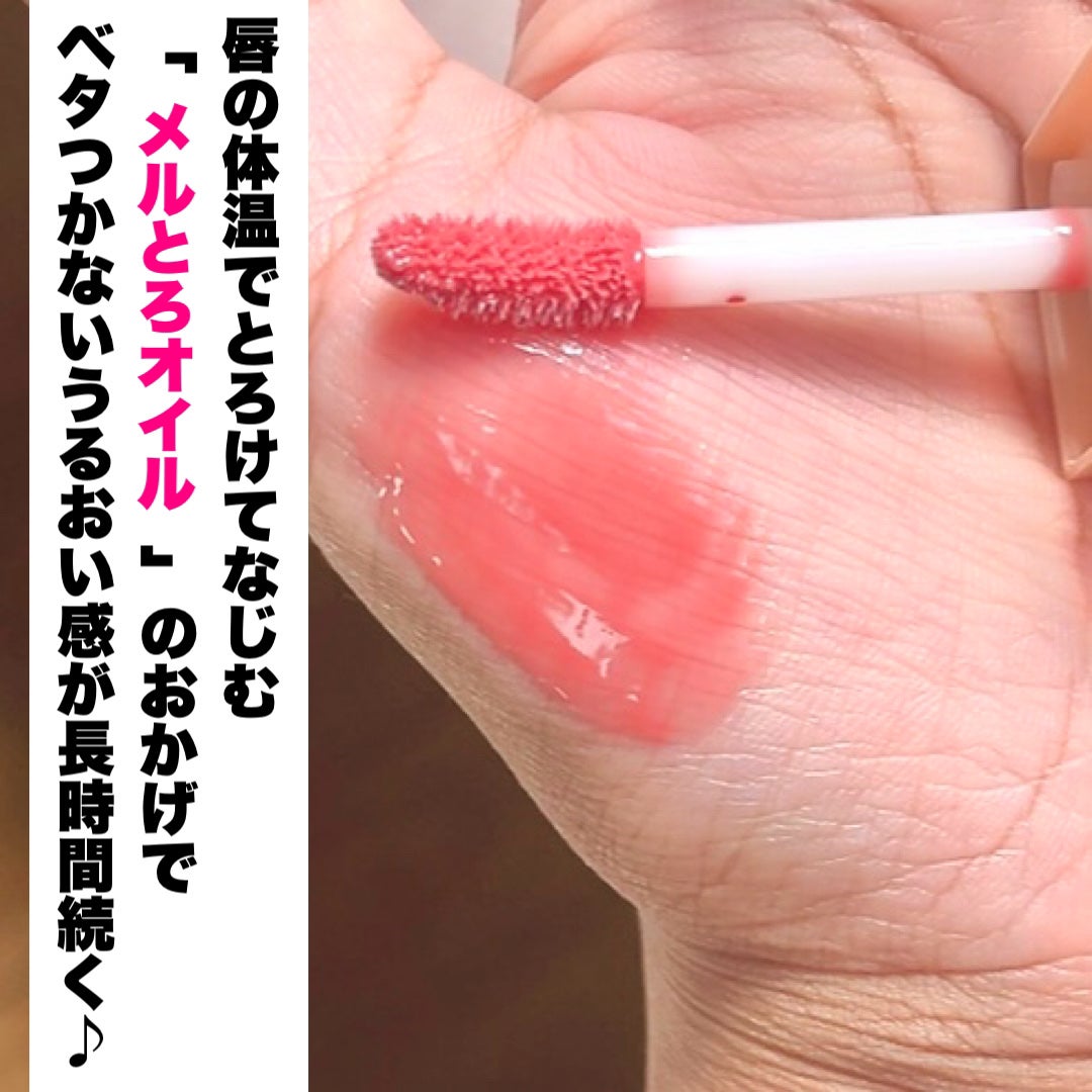 ニードルプランパー 高熱フィグ/Ui2./リッププランパーを使ったクチコミ(6枚目)