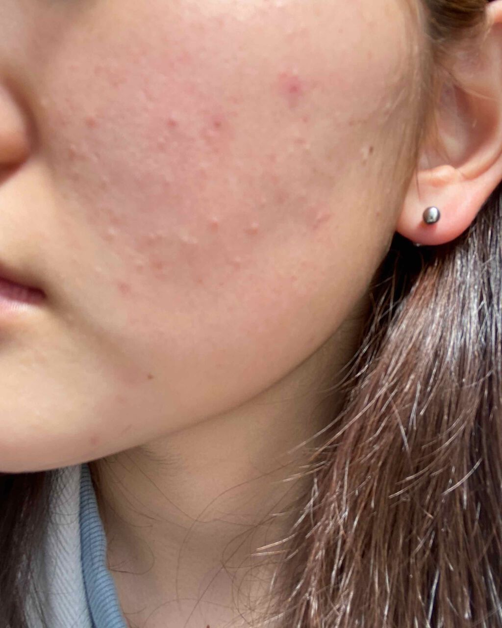 ハトムギ化粧水(ナチュリエ スキンコンディショナー R )/ナチュリエ/化粧水を使ったクチコミ（1枚目）