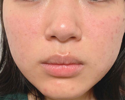 マイルドクレンジング オイル/ファンケル/オイルクレンジングを使ったクチコミ(1枚目)