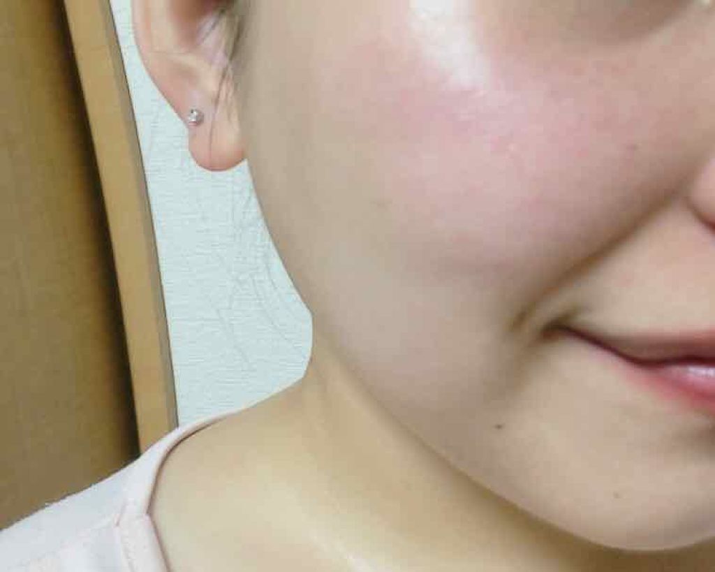 モイストバランス ローション/ACSEINE/化粧水を使ったクチコミ(3枚目)