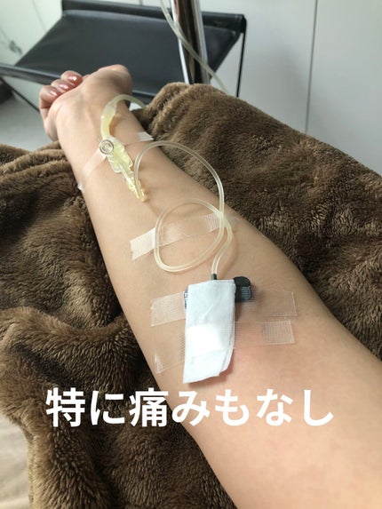 あぃち⭐︎ on LIPS 「二日酔いで昨日は一日中ダウン😭今日もまだ3日酔い中😱 美容目的..」(2枚目)