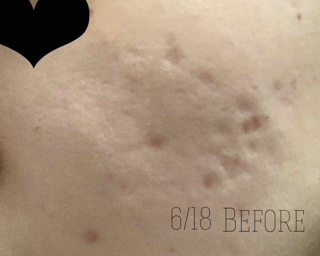 PLACENTREX EXTRACT GEL(ヒトプラセンタジェル)/Placentrex/その他を使ったクチコミ(2枚目)