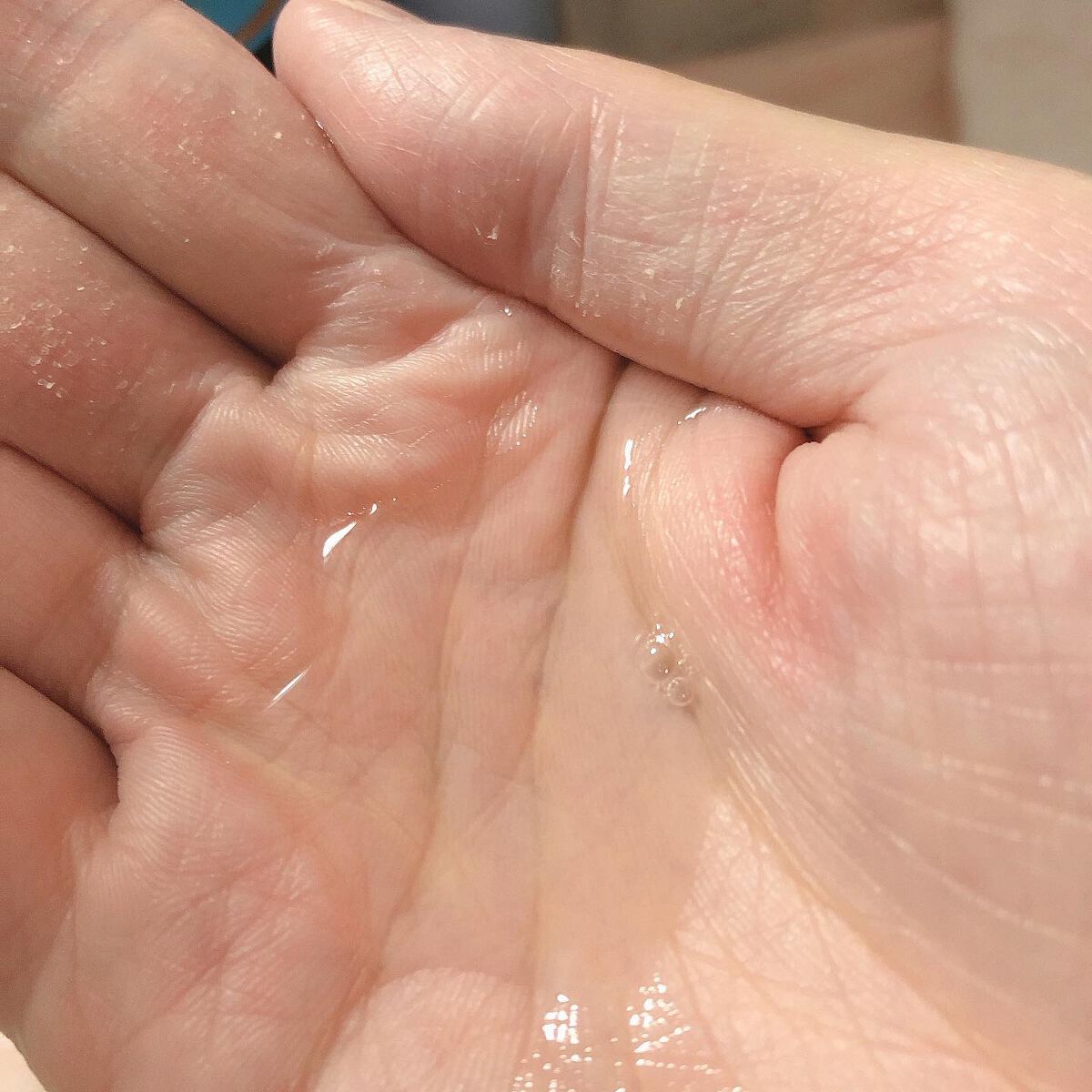 バランシングローション/スキンケールド/化粧水を使ったクチコミ(2枚目)