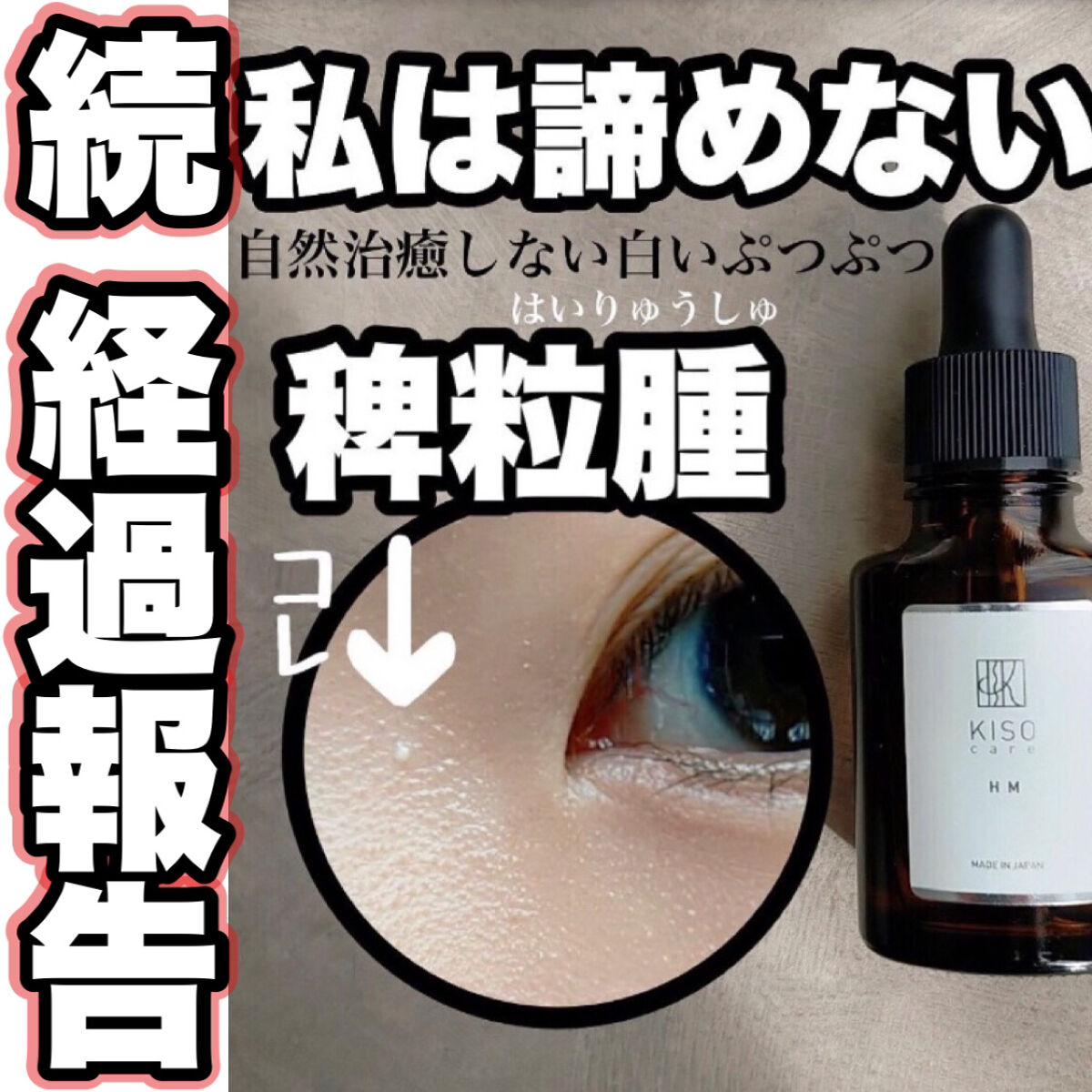 オーガニック ハトムギエキス (ヨクイニン)/KISO/その他を使ったクチコミ（1枚目）