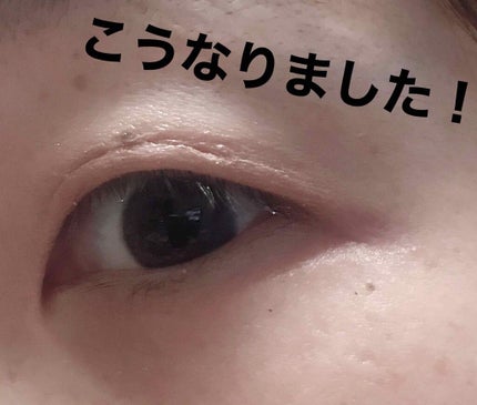 ラクオリ リキッドフィルムのクチコミ「自分はめちゃくちゃ重たい一重です!
今まで何をしてもうまく出来なかった...
あの!ふたえが!.....」(3枚目)