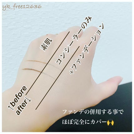 モイストラボ エッセンス薬用美白コンシーラー/Moist Labo/リキッドコンシーラーを使ったクチコミ(4枚目)