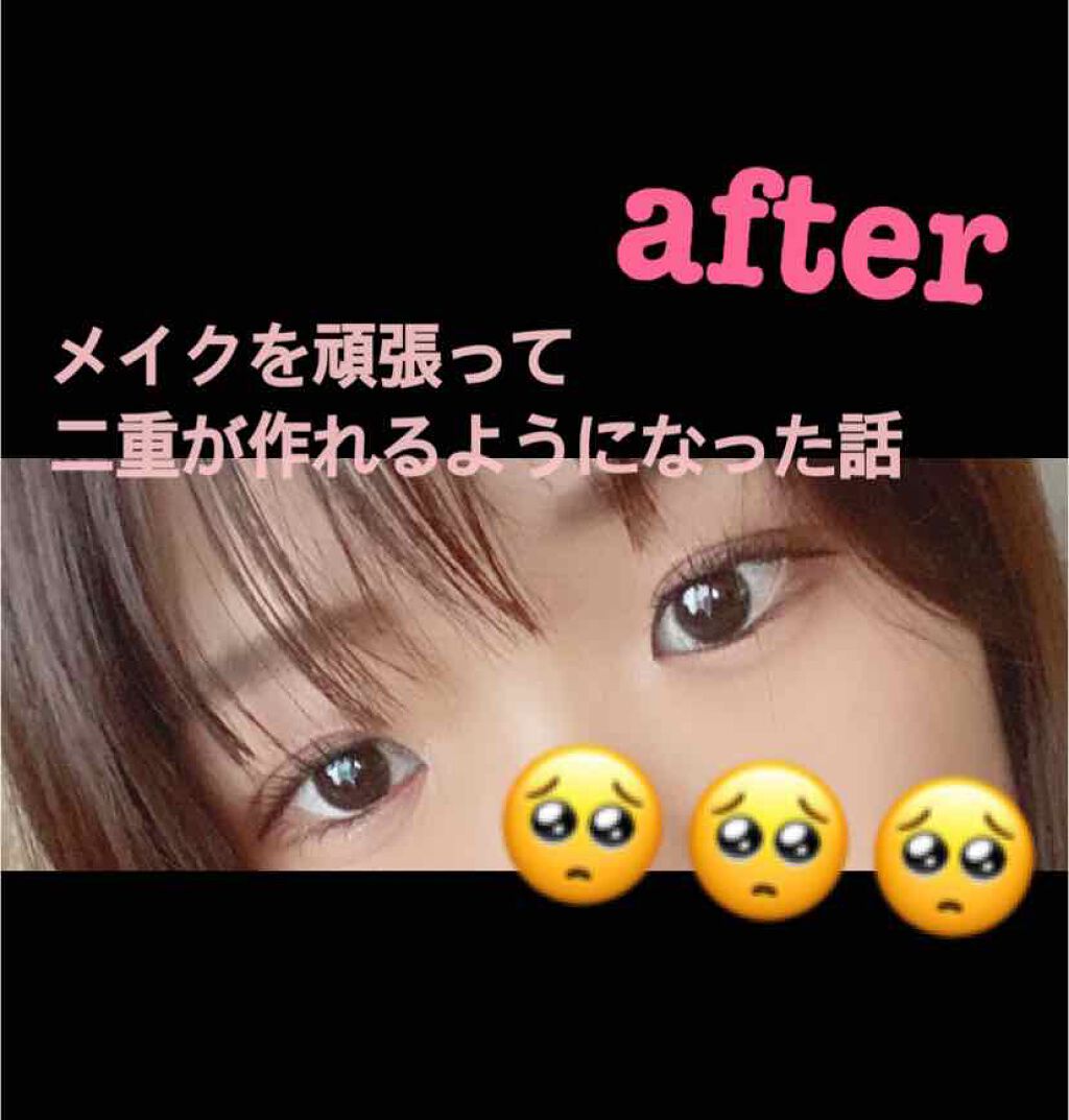 のびーるアイテープ（絆創膏タイプ、レギュラー）/DAISO/二重まぶた用アイテムを使ったクチコミ（2枚目）