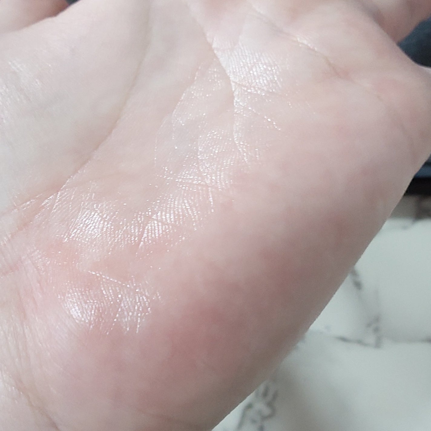 メディダーマ ニードルポアセラム800/メディダーマ/美容液を使ったクチコミ(4枚目)