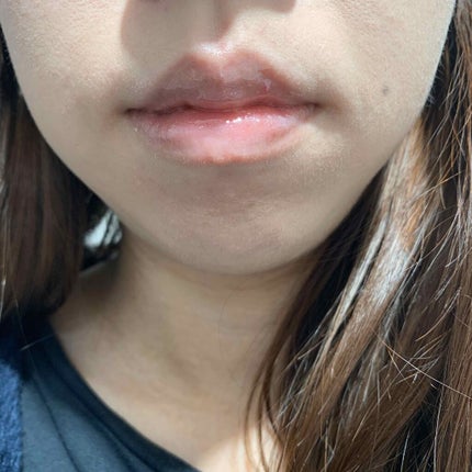 LIP38℃ +UnFrame<ホログラフィック>/UZU BY FLOWFUSHI/リップグロスを使ったクチコミ(4枚目)