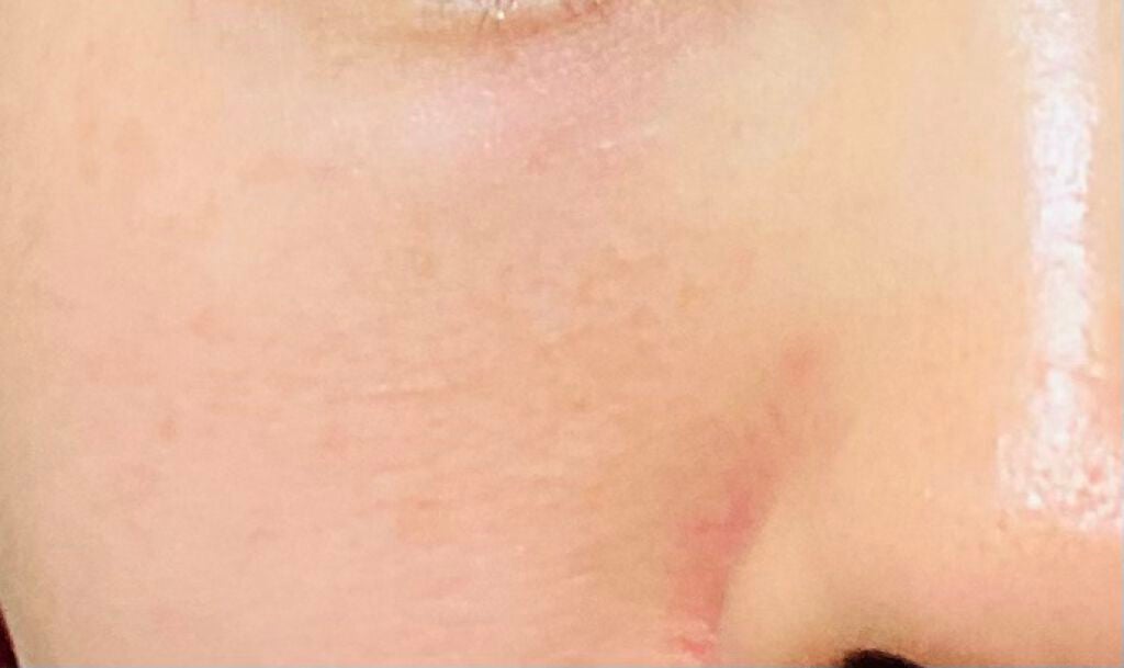 パック&マッサージフォーム/フレッシェル/洗顔フォームを使ったクチコミ(1枚目)