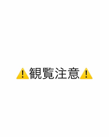 NOV A アクネソープのクチコミ「私の頬、ニキビだらけなんです😭
中学生の時からちょくちょくありましたが、今年のバレンタインから.....」（2枚目）