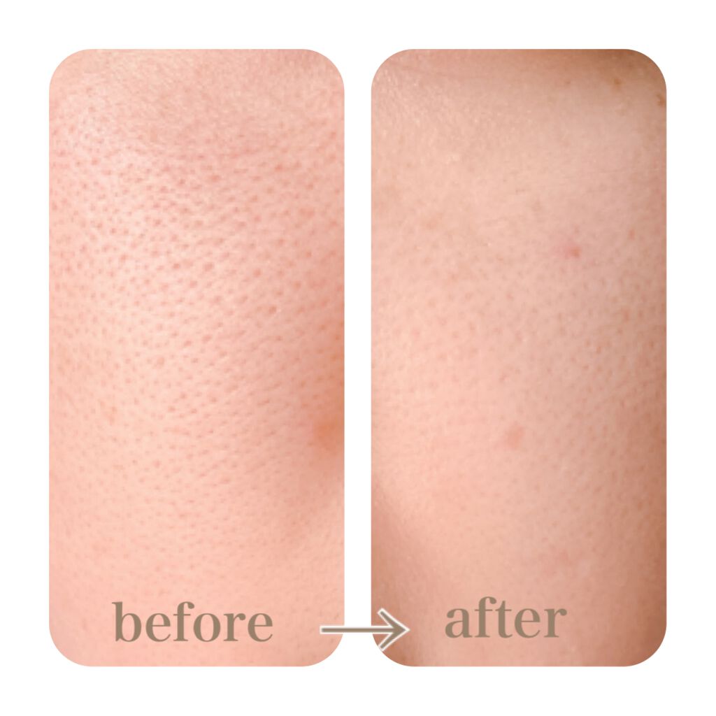 ドクタージャルト シカペア リカバー (第2世代)/Dr.Jart+/フェイスクリームを使ったクチコミ(4枚目)