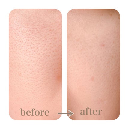 ドクタージャルト シカペア リカバー (第2世代)/Dr.Jart+/フェイスクリームを使ったクチコミ(4枚目)