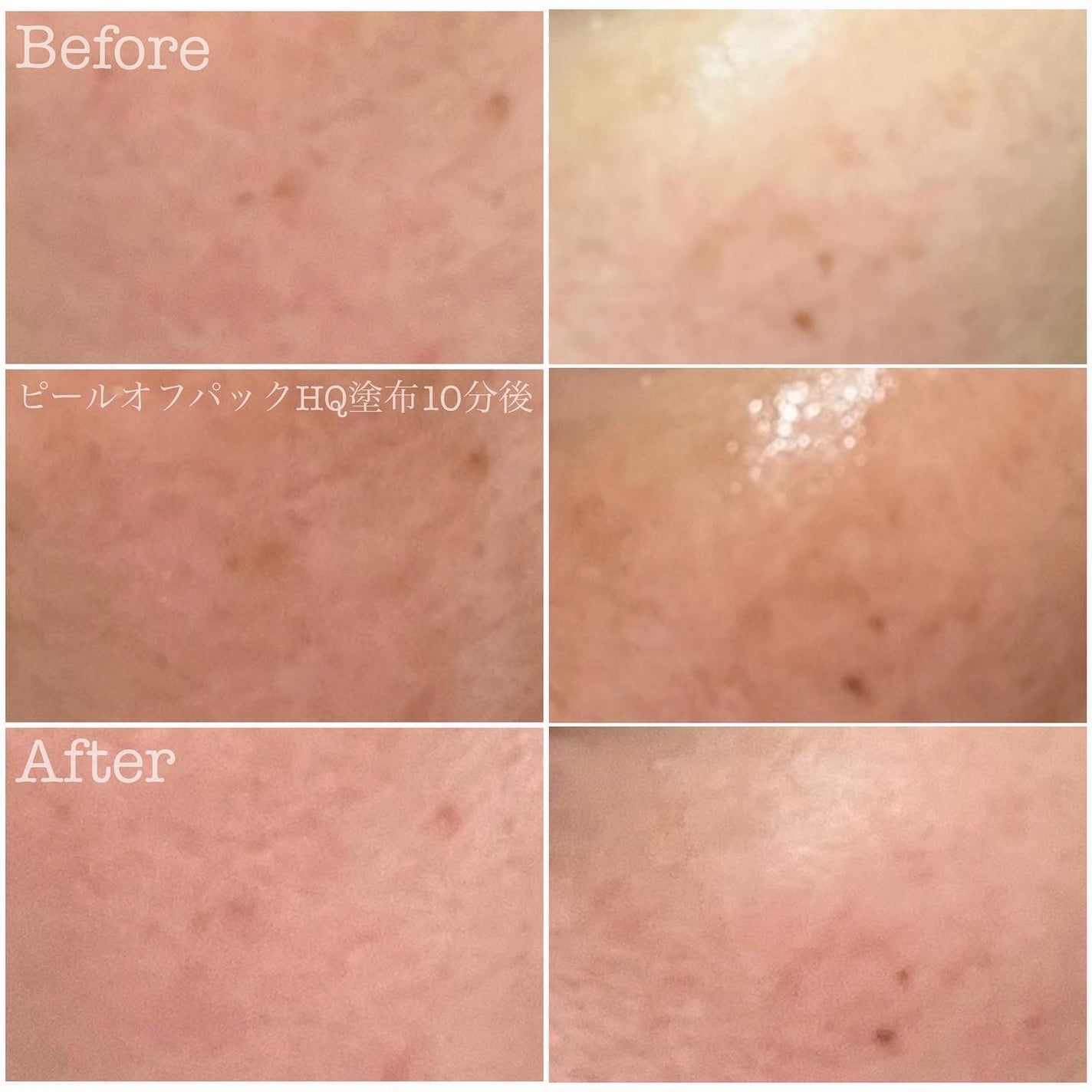 レディブラン ハイドロキールパックHQ/シーヴァ/洗い流すパック・マスクを使ったクチコミ(3枚目)