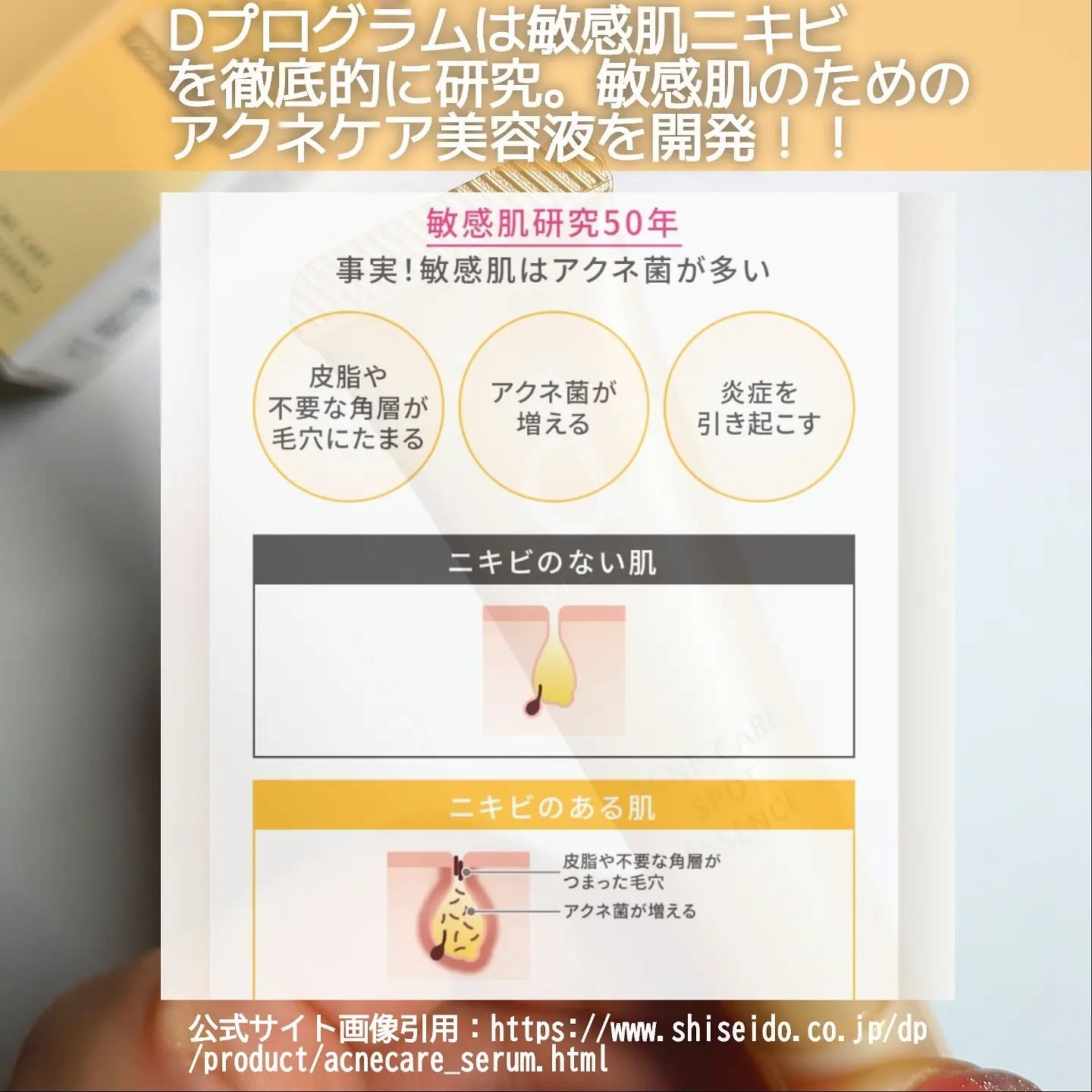 薬用 アクネケア美容液/d プログラム/美容液を使ったクチコミ（2枚目）