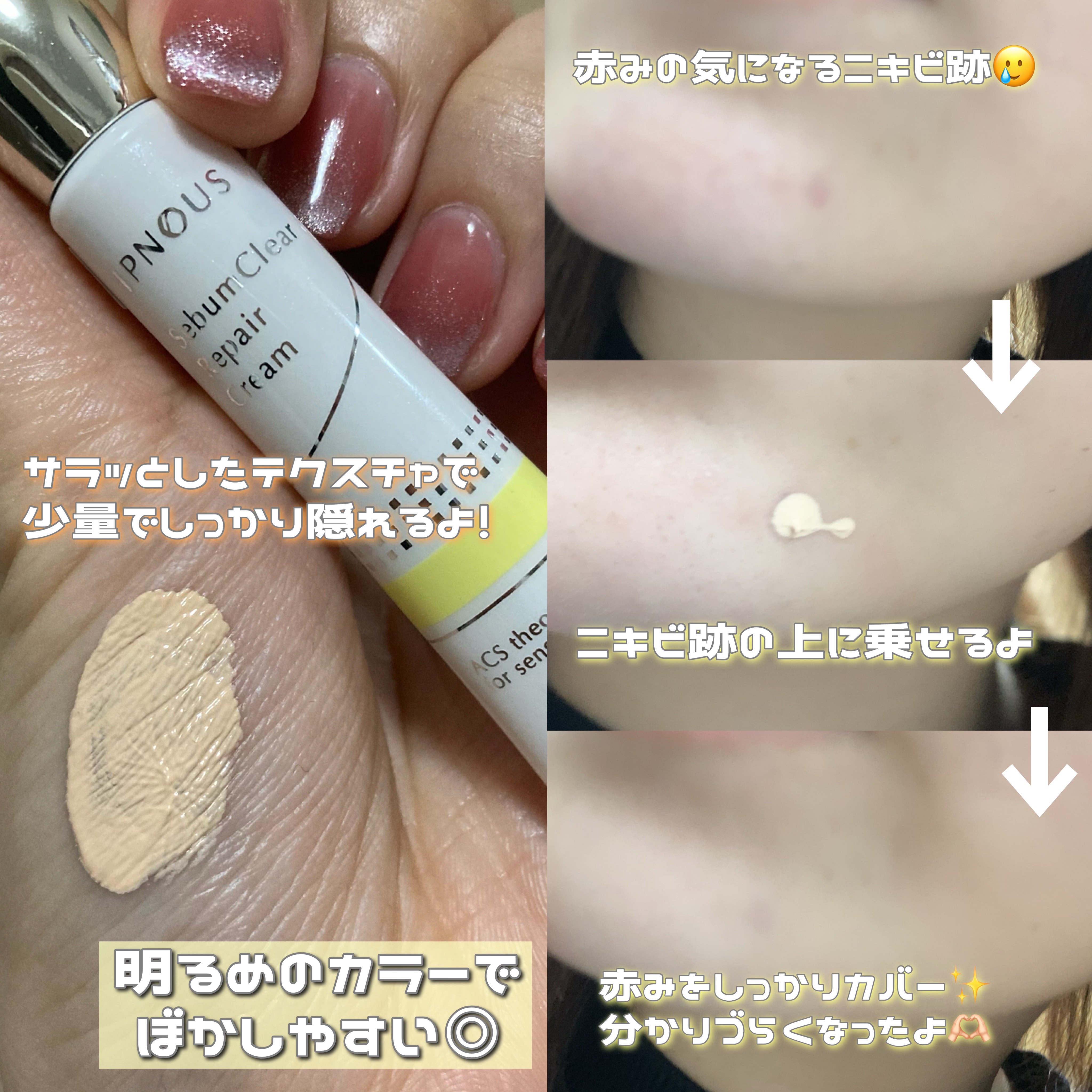 イプノス シーバムクリア リペアクリーム/ACSEINE/フェイスクリームを使ったクチコミ（2枚目）