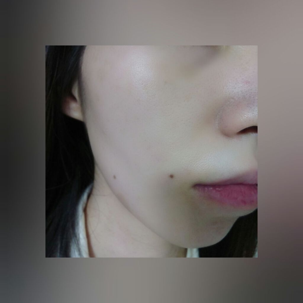 リペアローション/リソウコーポレーション/化粧水を使ったクチコミ(4枚目)