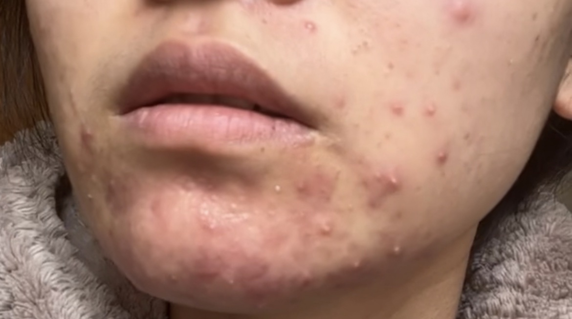 パントテン ウォーターパセリ クリアパッド/SKINFOOD/トナーパッドを使ったクチコミ（2枚目）