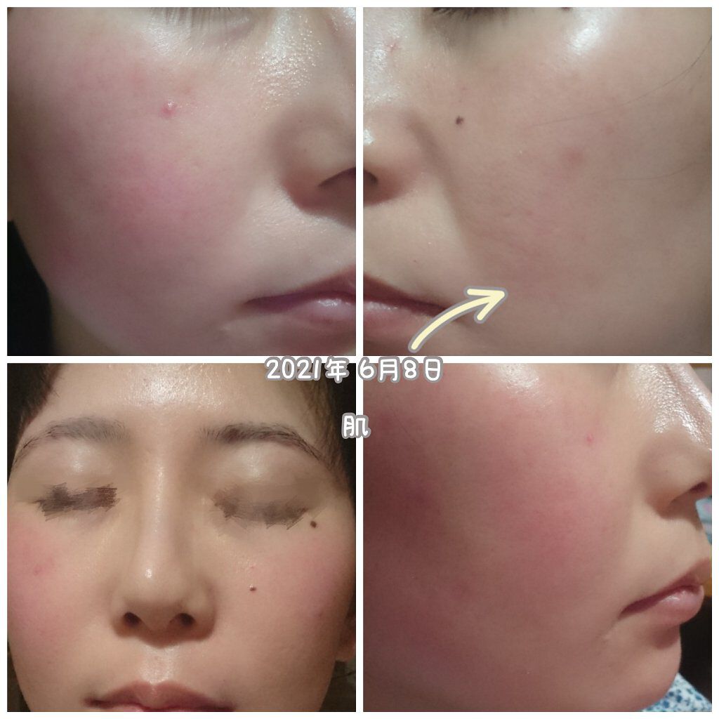 リトルサンクスC ヨモギローション/自然化粧品研究所/化粧水を使ったクチコミ（3枚目）