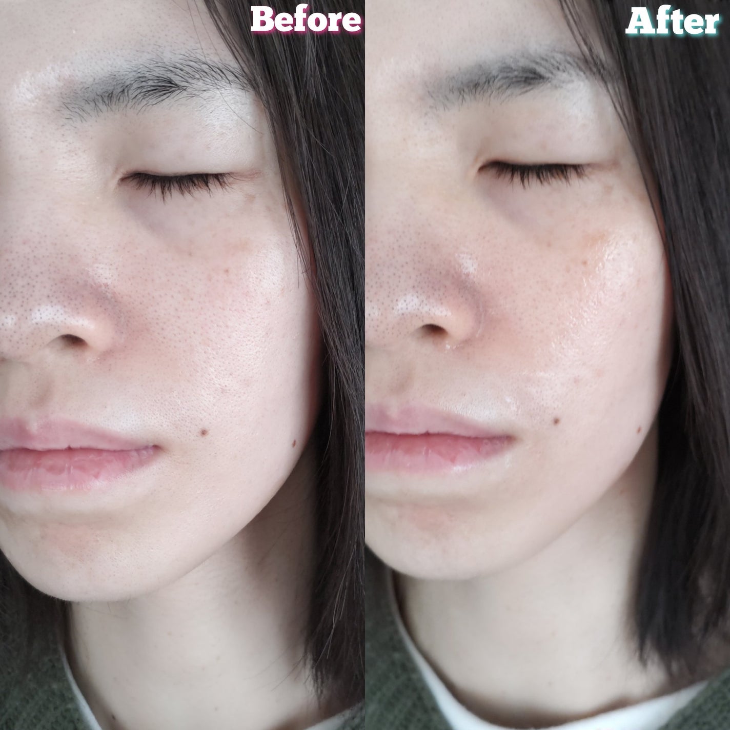 ポストアルファクーリングパッド/Cell Fusion C(セルフュージョンシー)/トナーパッドを使ったクチコミ(6枚目)