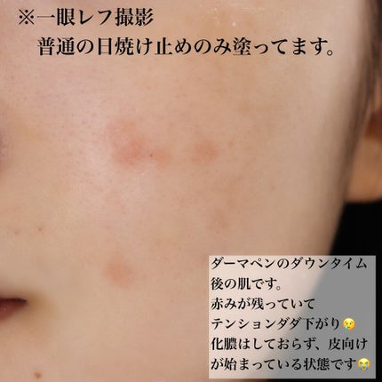 マットシフォン UVホワイトニングベースN/KiSS/化粧下地を使ったクチコミ(3枚目)