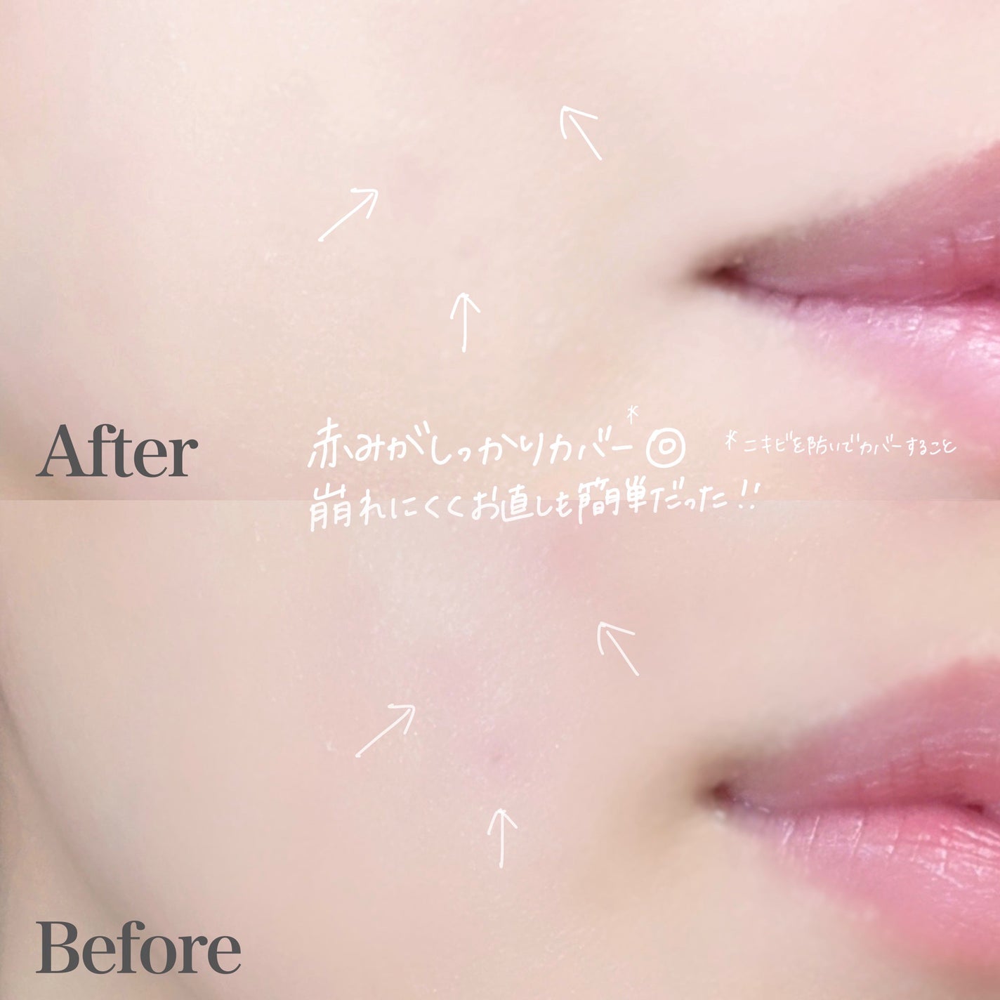 イプノス シーバムクリア リペアクリーム/ACSEINE/フェイスクリームを使ったクチコミ(4枚目)